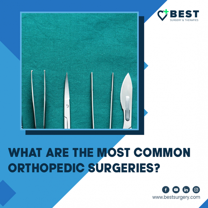 What Are The Most Common Orthopedic Surgeries Best Surgery Center In Cincinnatti Ohio
