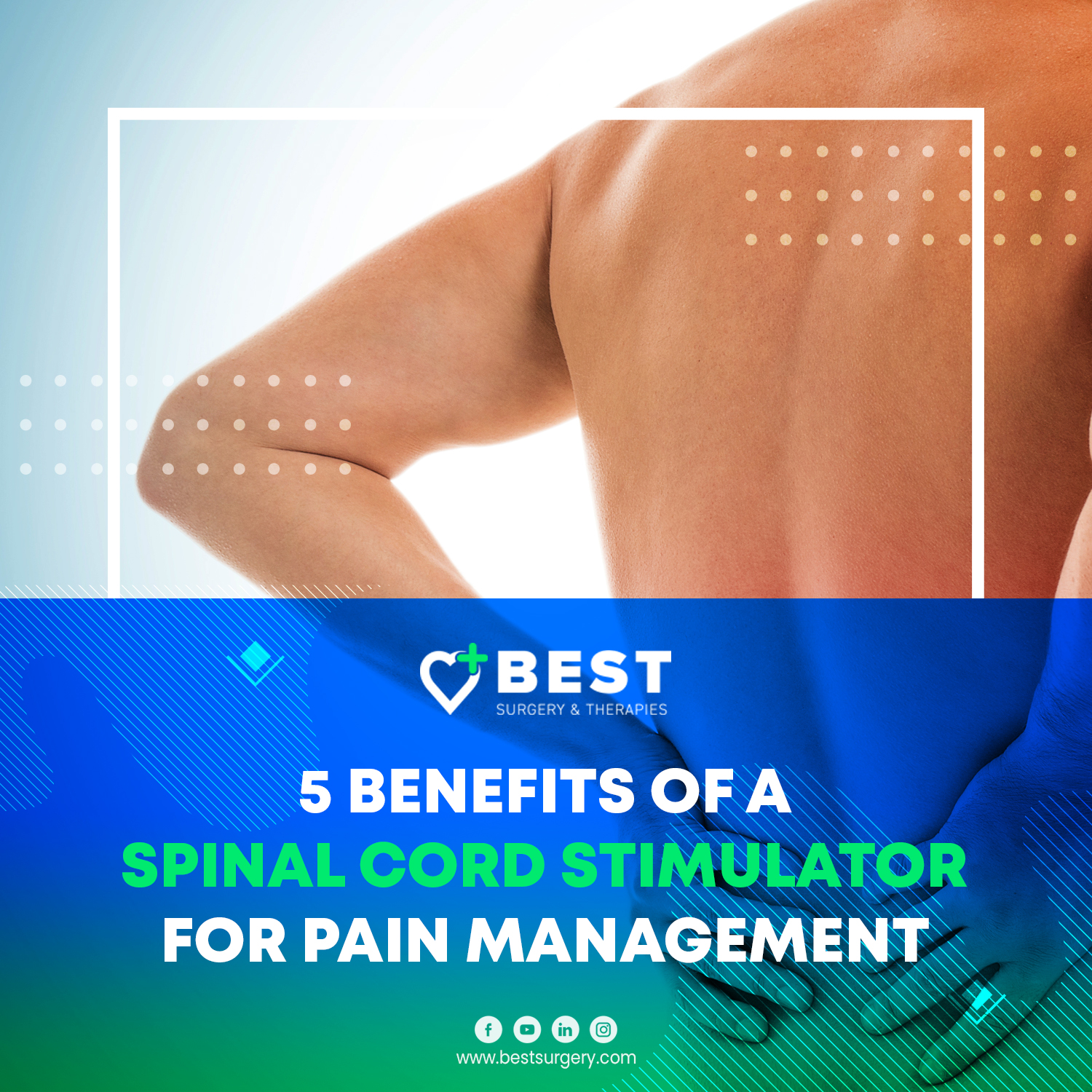 5 Benefits of a Spinal Cord Stimulator for Pain Management Best