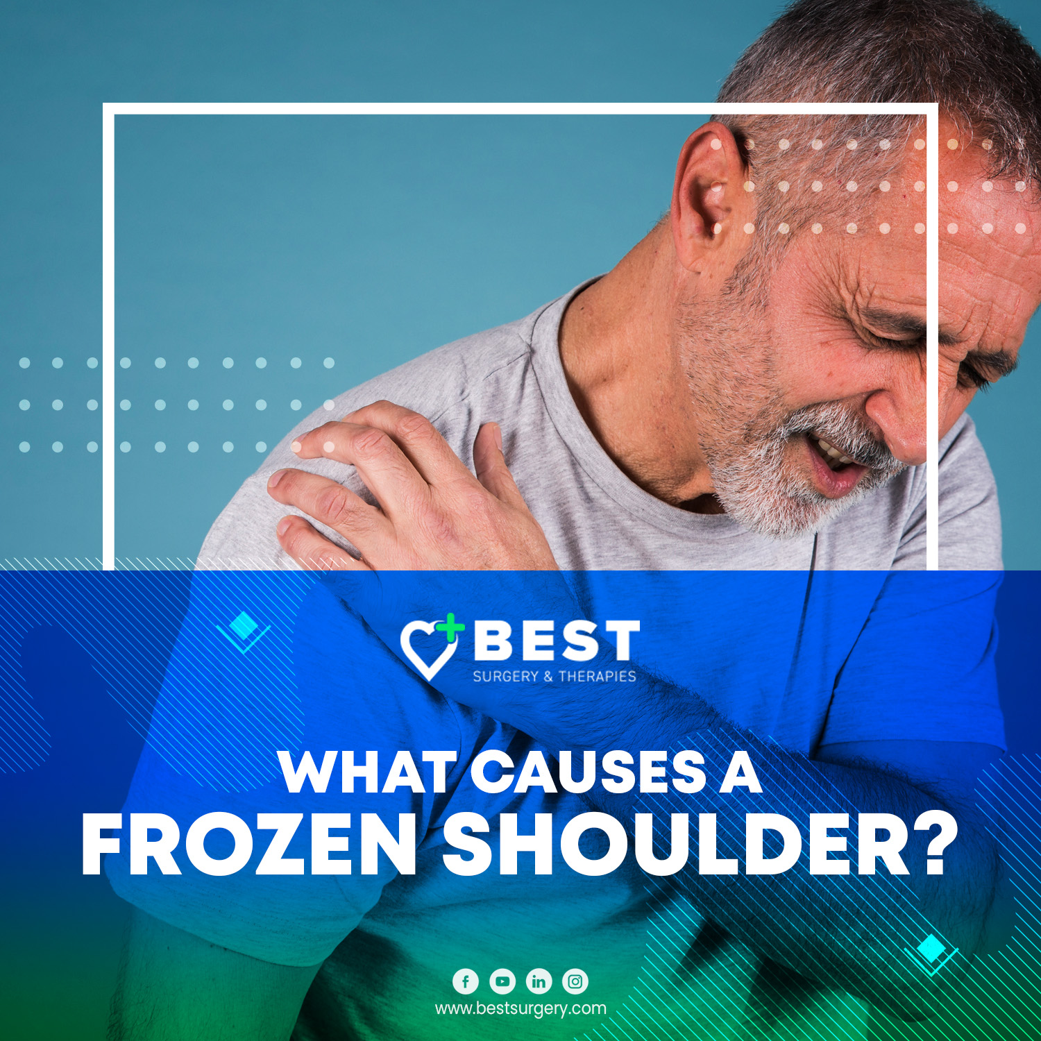 What Causes Frozen Shoulder Best Surgery Center 5409